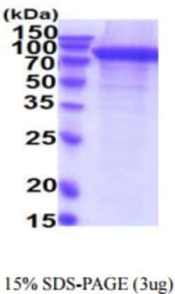 Novus Biologicals™ Human ErbB2/Her2 Recombinant Protein